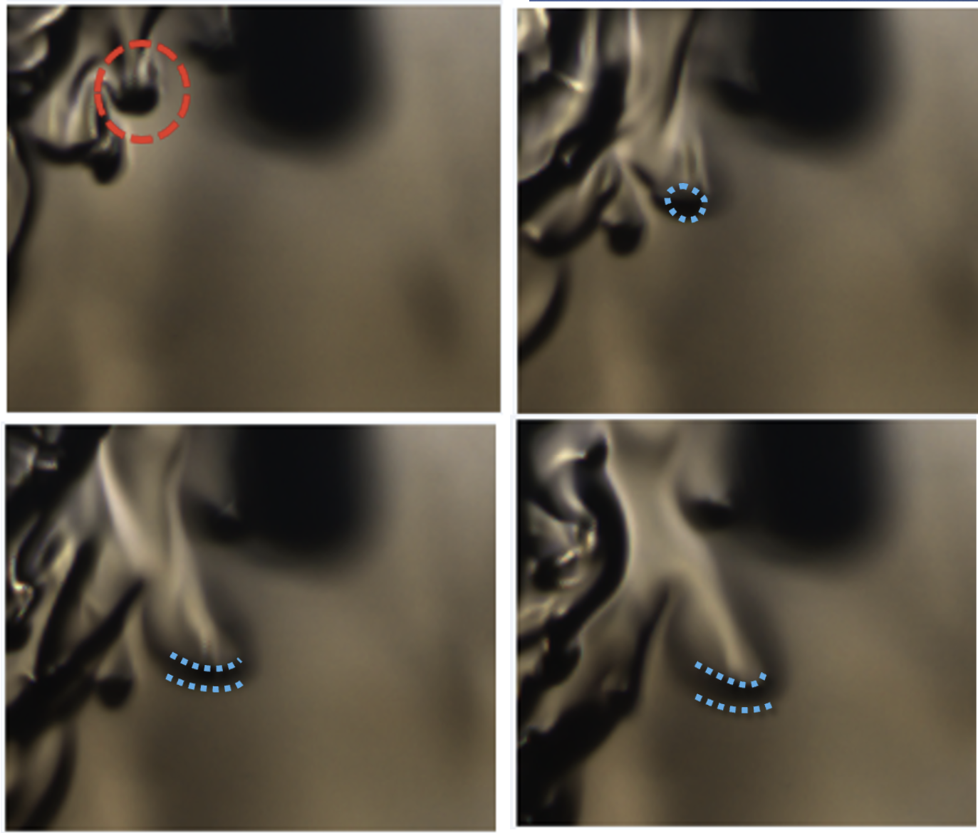 Experimental shadowgraphy snapshots of a fuel droplet undergoing transcritical transition